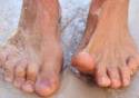 El mal olor es una de las principales afecciones de los pies durante el otoño